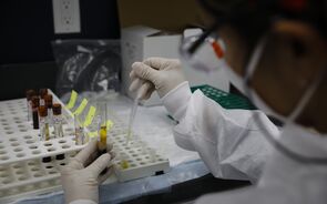 Universidade de Oxford promete distribuir 200 milhões de doses de vacinas ainda este ano