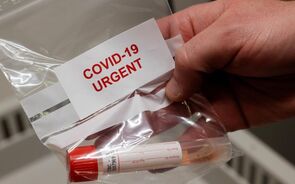 Portugal soma mais 58 mortes por covid-19 e regista semana com menos casos desde outubro